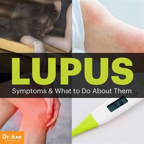 Dont Ignore These Lupus Symptoms Lupus Symptoms Thyroid Health Lupus