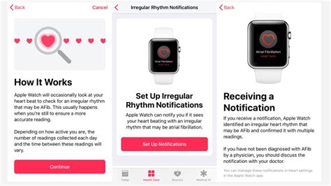 I know that you must be tired from all the tutorials about social media and apps but this one you should definitely consider if you want to increase your website traffic. Apple Watch ECG app: what is it, how does it work and is ...