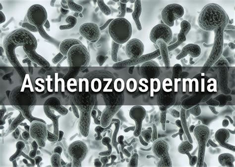 What Is Asthenozoospermia Causes Effects Diagnosis And Treatment
