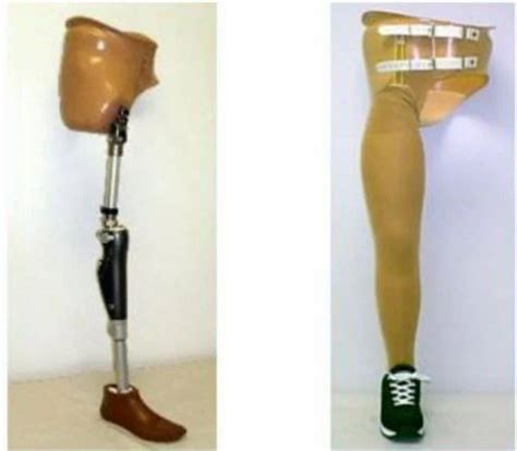 Hip Disarticulation Prostheses At Rs 110000 Bipolar Prosthesis In