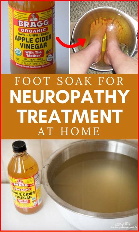 Foot Soak For Neuropathy Treatment At Home Neuropathy Treatment Health Remedies Neuropathy