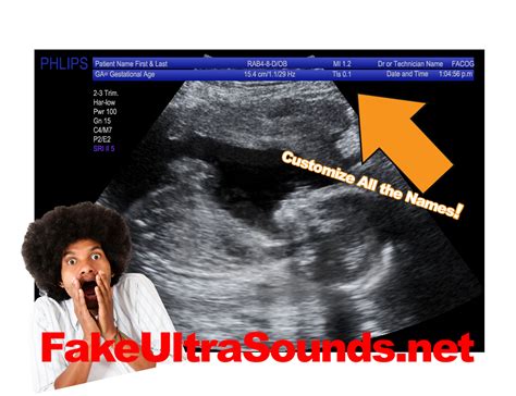 Fake Ultrasound Pranks Online - FakeUltrasounds.Net