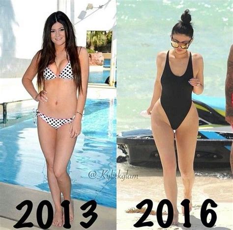 Kylie Jenners Plastic Surgery Kylie Jenner Body Kylie Jenner