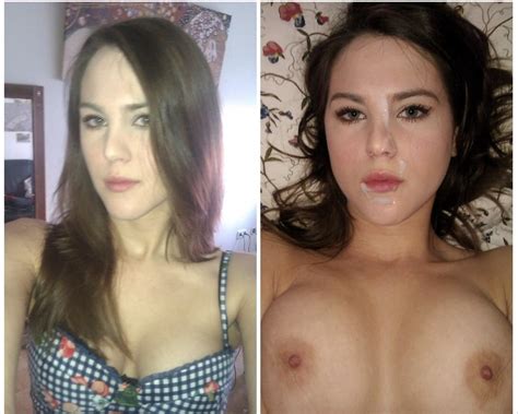 Saggy Breasts Before And After Implants Fareconnectblog