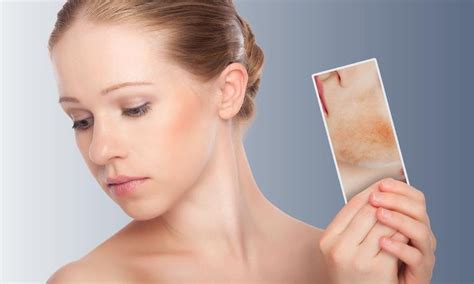 Macchie rosse sul viso: cause e rimedi naturali