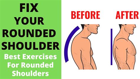 How To Fix Rounded Shoulders Permanently 4 Easy Exercises Improve