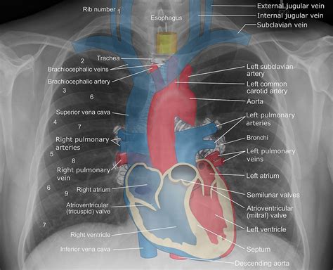 Radiograph Anatomy Anatomical Charts Posters