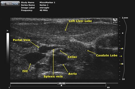 Hemodynamic Correlates Of Drug Induced Vascular Injury In The Rat Using