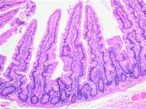 Small Intestine Histology Diagram