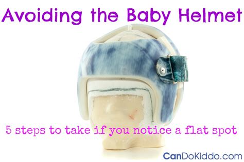 Positional Plagiocephaly What To Do If Your Babys Head