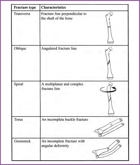 Fracture Types Overview Musculoskeletal Key