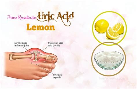 19 Natural Home Remedies For Uric Acid Control