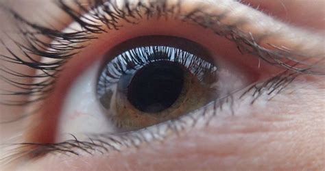 Qu Es El Glaucoma Ocular S Ntomas Y Tratamientos Hora Es