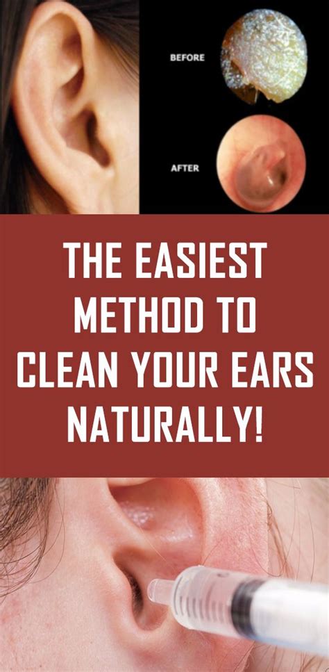 The Easiest Method To Clean Your Ears Naturally Cleaning Your Ears