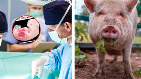 Scientists Create Human Kidney Inside A Pig To Have Infinite Organs