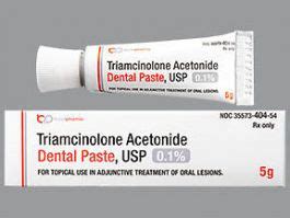 Triamcinolone is commonly used in various conditions and is available in oral, nasal, injectable, topical, ophthalmic injection, and spray preparations. Triamcinolone Oral Paste