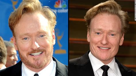 At an early age, he developed a love of comedy and goofing off, this carried on when he entered the prestigious harvard university, acting out many pranks in his time. Beard envy? Surgery may be the answer - CNN