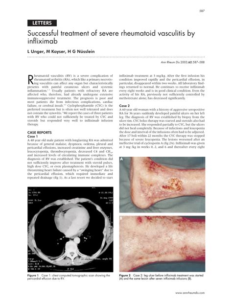 Pdf Successful Treatment Of Severe Rheumatoid Vasculitis By Infliximab