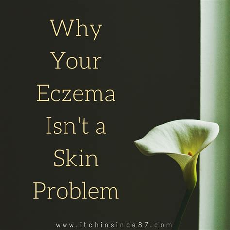 Why Your Eczema Isnt A Skin Problem