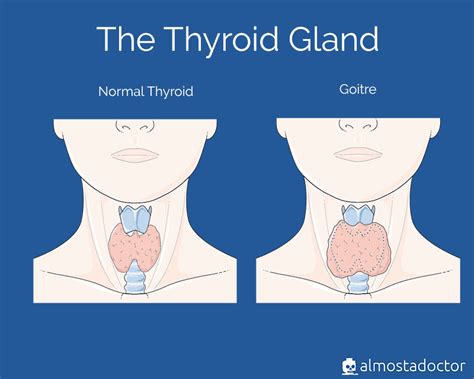 Normal Thyroid