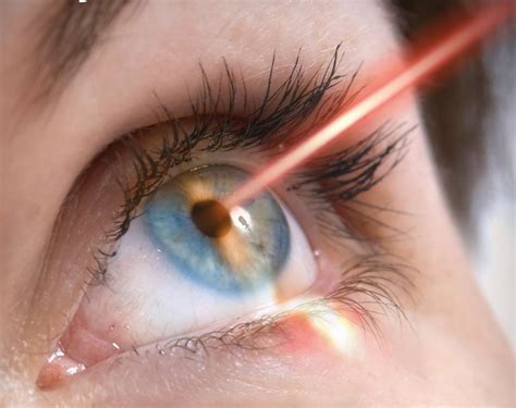 Advantage And Disadvantage Of Laser Eye Treatment