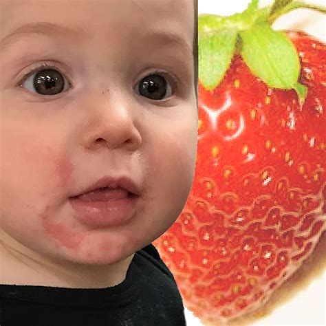 Raspberry Allergy Baby Raspberry