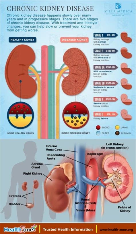 The Kidneys Human Anatomy Function Diseases Medical Tests