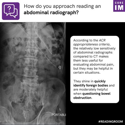 Approach To Reading An Abdominal Radiograph Core Im Podcast