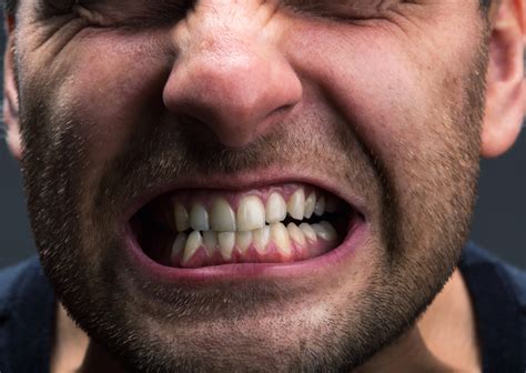 Top Six Signs That Youre Grinding Your Teeth