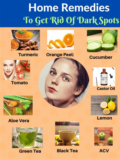 21 Top Home Remedies For Dark Spots You Must Know My Health Only