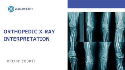 Orthopedic X Ray Interpretation Skills On Point Llc