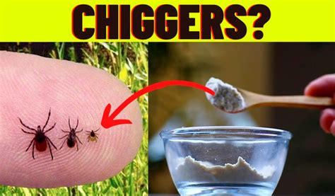 How To Easy Get Rid Of Chiggers In Your Yard In 2022