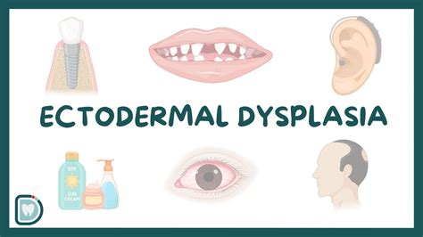 Understanding Ectodermal Dysplasia Causes Diagnosis Types And