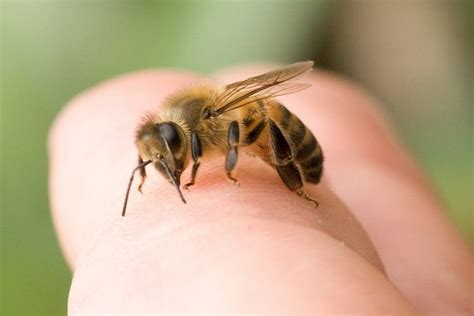 Bee Sting Allergy Symptoms And Other Risk Factors