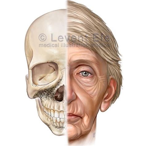 Skeletal Aging And Consequences Dr Efes Medical Art Store Medical