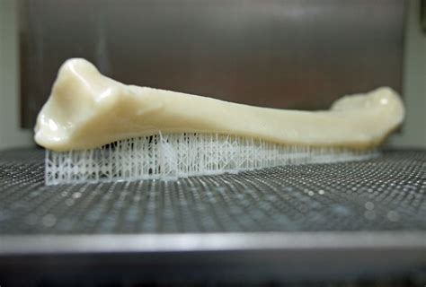 3d Printing Damaged Bones For Surgery Prep Todays Medical Developments