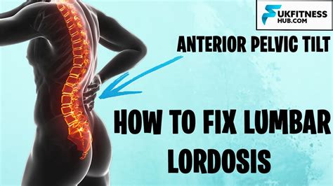 How To Fix Lumbar Lordosis And Anterior Pelvic Tilts Full Exercise