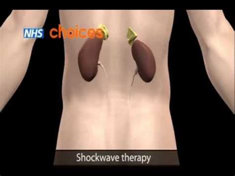 It stretches to store urine and contracts to release urine. Kidney Stones - YouTube