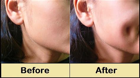 How To Get Dimples Fast And Naturally Simple Facial Exercise To Get