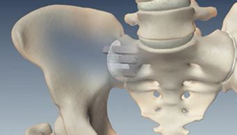 Treatment Options For Sacroiliac Joint Disorders Michigan Brain