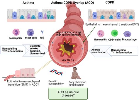 Pathogenesis Clinical Features Of Asthma Copd Overlap And Therapeutic