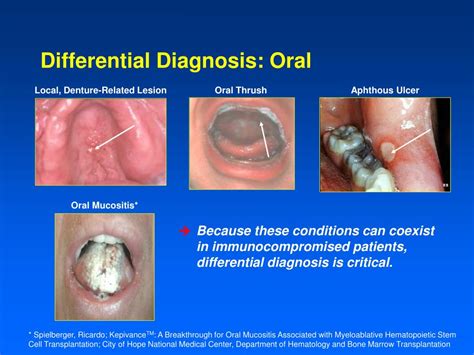 A Guide To Clinical Differential Diagnosis Of Oral Mucosal Lesions My