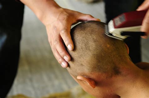 Cancer Sufferers Label Shaven Head Fundraiser Offensive And Facile