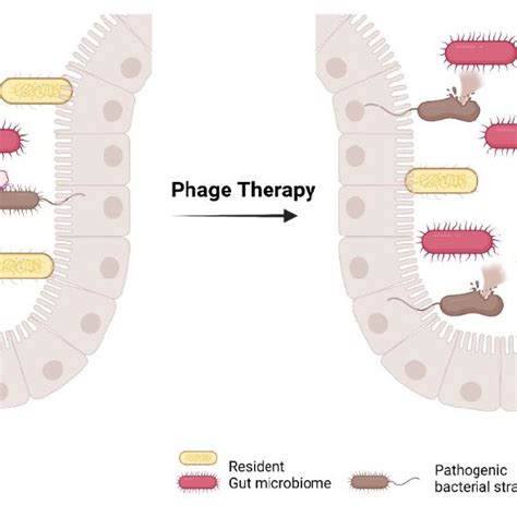 Traditional Phage Therapy For Gut Dysbiosis With Pathogenic Microbiome