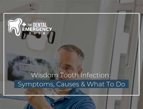 How To Treat Abscessed Tooth Symptoms Causes And Relief