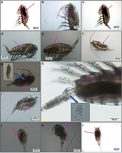 Endo Parasite Blastodinum Infection In The Digestive Tract Of Copepods