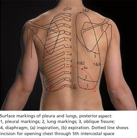 Lung Markings Posterior Material De Enfermagem Técnico Em