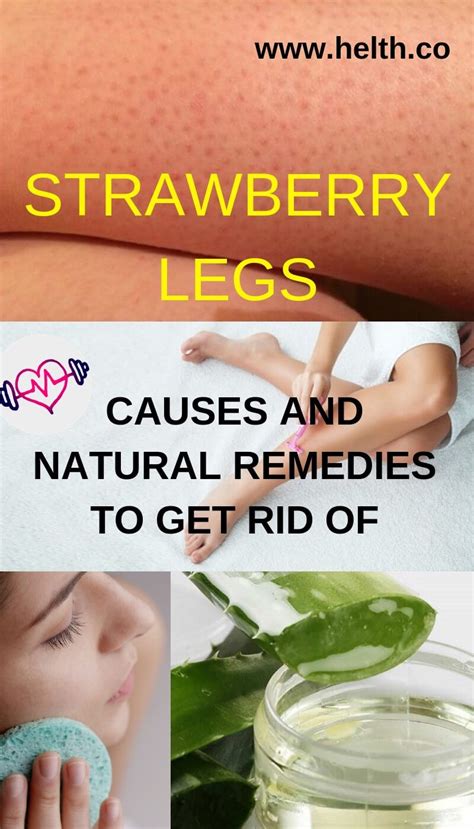 How To Get Rid Of Strawberry Legs Black Marks On Legs Strawberry