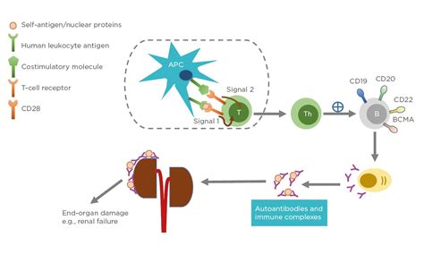 Expanding The Role Of Car T Cell Therapy To Systemic Lupus