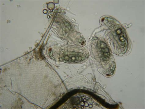 Aglphoto Se Digitalbild Mikroskop Cellen